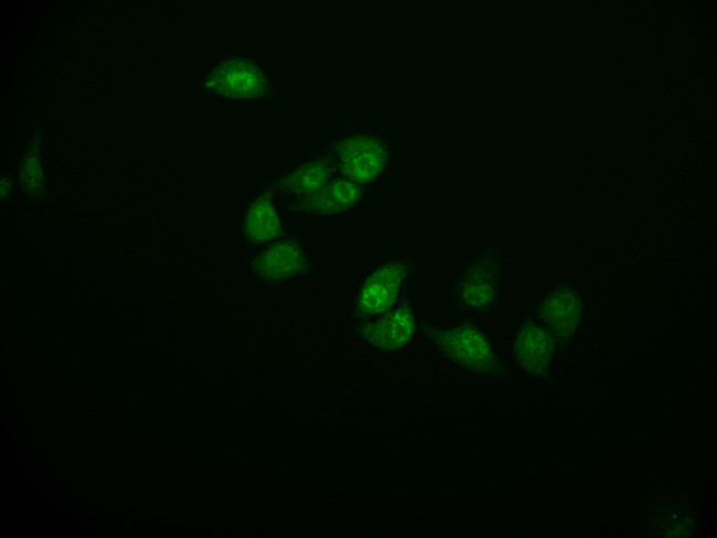 Cystatin B Antibody in Immunocytochemistry (ICC/IF)