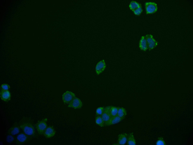 RGS6 Antibody in Immunocytochemistry (ICC/IF)