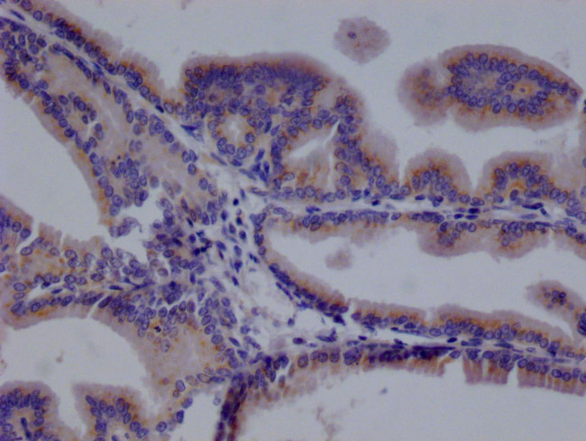 TMEM192 Antibody in Immunohistochemistry (Paraffin) (IHC (P))