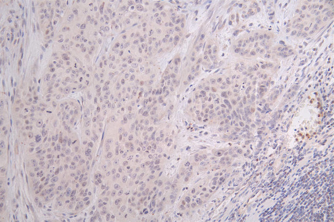 Formyl-Histone H3 (Lys122) Antibody in Immunohistochemistry (Paraffin) (IHC (P))