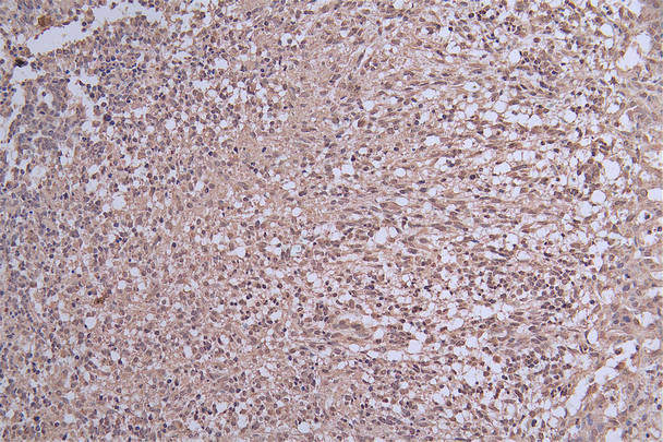 Ferritin Light Chain Antibody in Immunohistochemistry (Paraffin) (IHC (P))