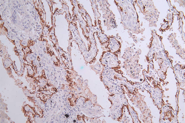 Aquaporin 4 Antibody in Immunohistochemistry (Paraffin) (IHC (P))