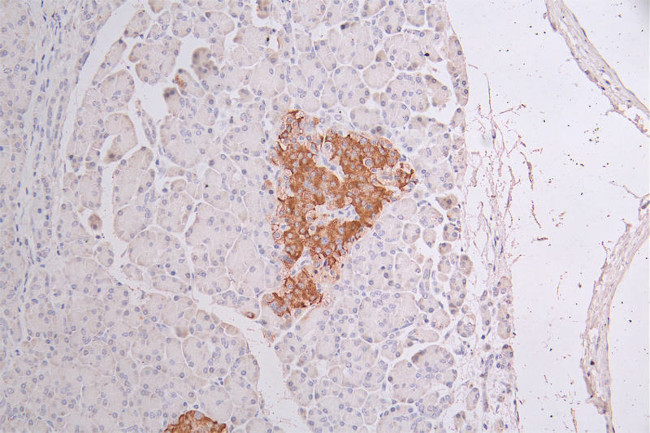 Cytokeratin 10 Antibody in Immunohistochemistry (Paraffin) (IHC (P))