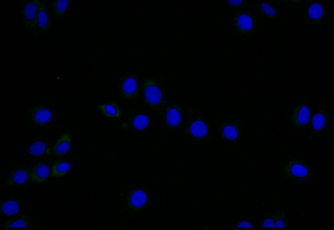 LYVE1 Antibody in Immunocytochemistry (ICC/IF)