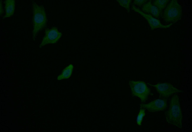RelB Antibody in Immunocytochemistry (ICC/IF)