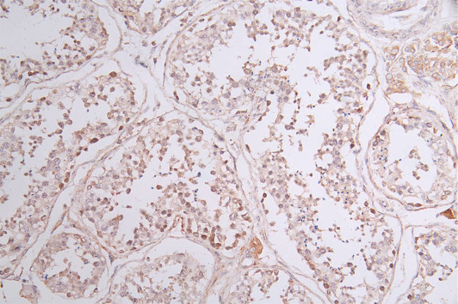 SOCS7 Antibody in Immunohistochemistry (Paraffin) (IHC (P))