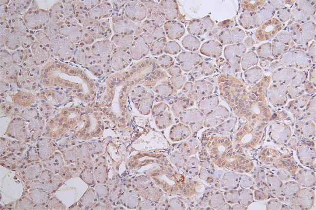 DDB2 Antibody in Immunohistochemistry (Paraffin) (IHC (P))