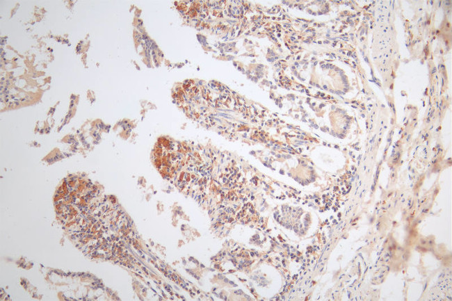MICA Antibody in Immunohistochemistry (Paraffin) (IHC (P))