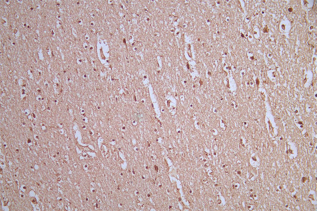 AKT Pan Antibody in Immunohistochemistry (Paraffin) (IHC (P))
