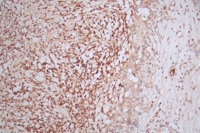 Pax Rabbit PAX6 Recombinant Rabbit Monoclonal Antibody (22C3) | Invitrogen (MA5-50174)