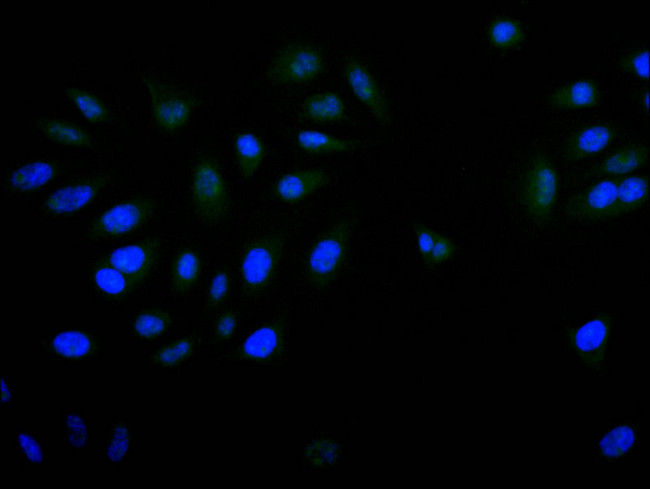 PITX3 Antibody in Immunocytochemistry (ICC/IF)