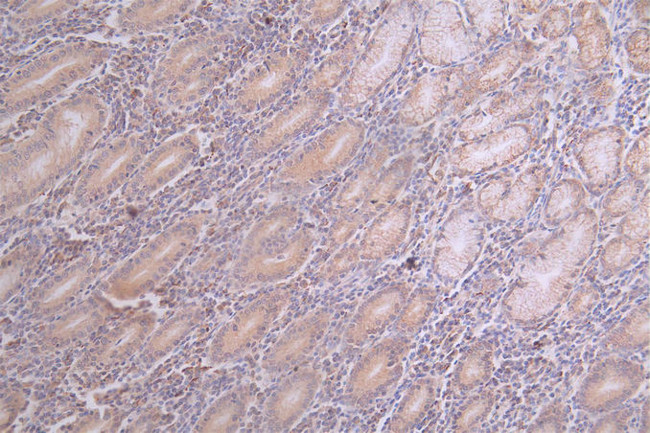 Acetyl-SOD2 (Lys68) Antibody in Immunohistochemistry (Paraffin) (IHC (P))