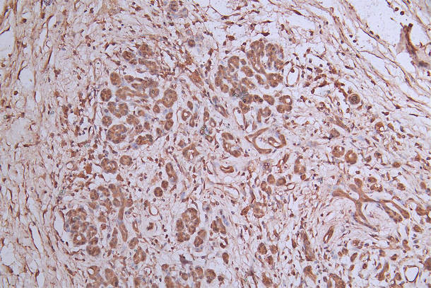 TUBB1 Antibody in Immunohistochemistry (Paraffin) (IHC (P))