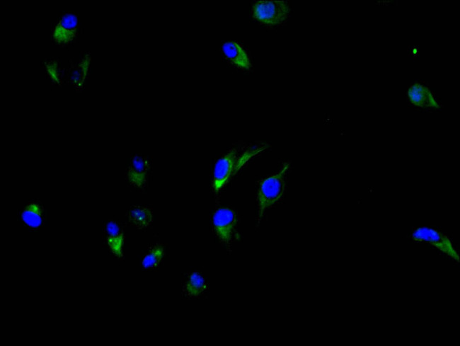 CEA Antibody in Immunocytochemistry (ICC/IF)