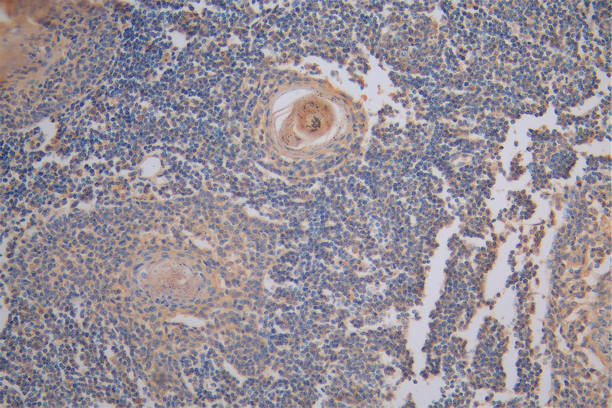 Fascin Antibody in Immunohistochemistry (Paraffin) (IHC (P))