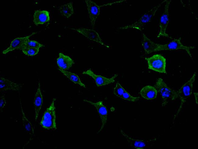 uPAR Antibody in Immunocytochemistry (ICC/IF)