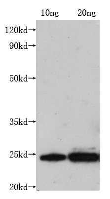 Rabies Virus Matrix Protein Antibody in Western Blot (WB)