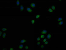 USP6 Antibody in Immunocytochemistry (ICC/IF)