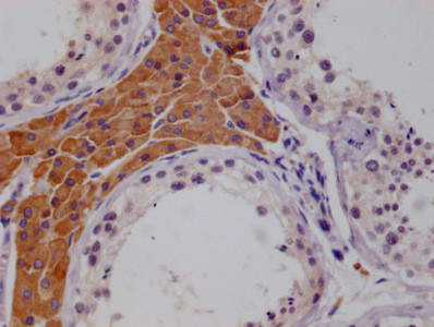 MCM9 Antibody in Immunohistochemistry (Paraffin) (IHC (P))