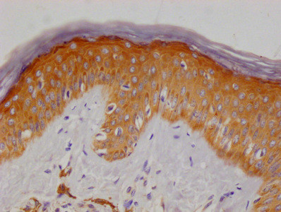 METRNL Antibody in Immunohistochemistry (Paraffin) (IHC (P))