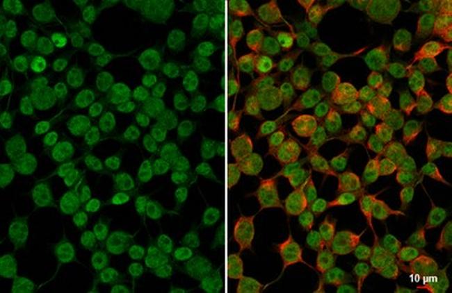 PAX6 Antibody in Immunocytochemistry (ICC/IF)