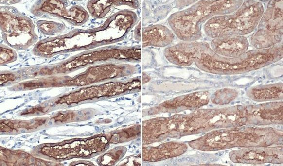 ACE2 Antibody in Immunohistochemistry (Paraffin) (IHC (P))