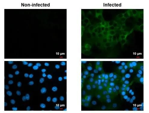 Chikungunya Virus NSP2 Antibody in Immunocytochemistry (ICC/IF)