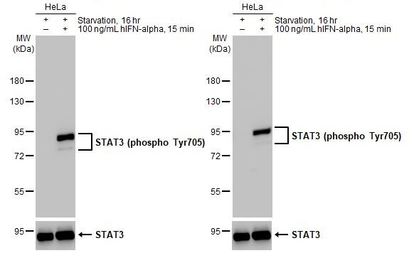 Phospho-STAT3 (Tyr705) Antibody in Western Blot (WB)