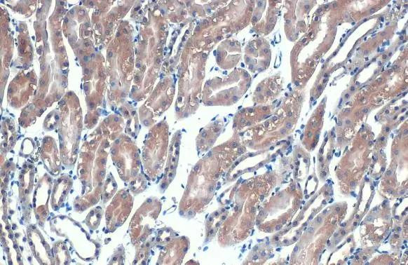 eIF4E Antibody in Immunohistochemistry (Paraffin) (IHC (P))