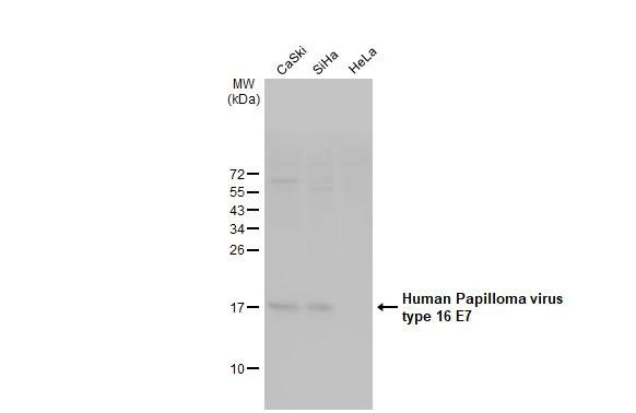 HPV Type 16 E7 Antibody in Western Blot (WB)