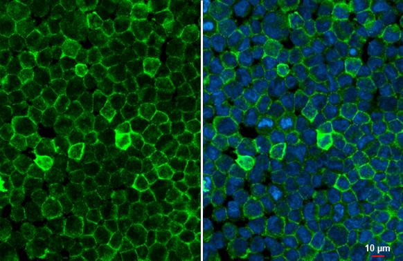 FCGR2B Antibody in Immunocytochemistry (ICC/IF)