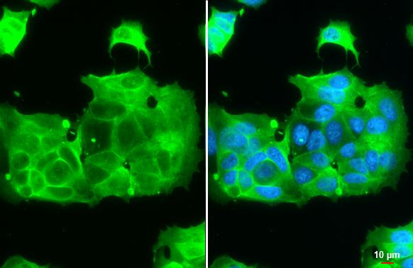 IGF1R (CD221) Antibody in Immunocytochemistry (ICC/IF)