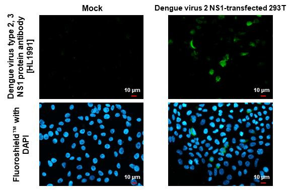 Dengue virus Type 2/3 NS1 Antibody in Immunocytochemistry (ICC/IF)