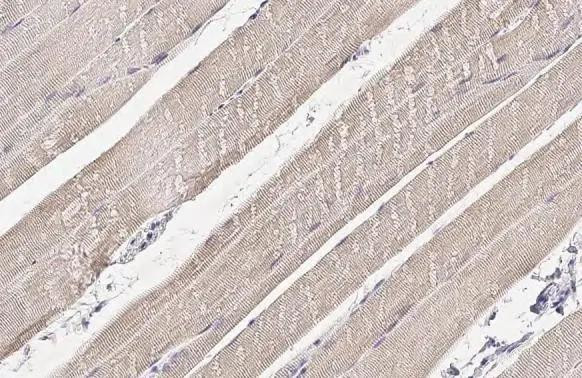 PDLIM3 Antibody in Immunohistochemistry (Paraffin) (IHC (P))