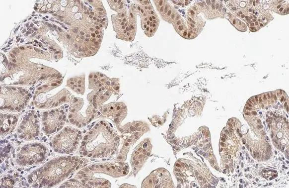 HAX1 Antibody in Immunohistochemistry (Paraffin) (IHC (P))
