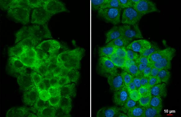 WARS Antibody in Immunocytochemistry (ICC/IF)