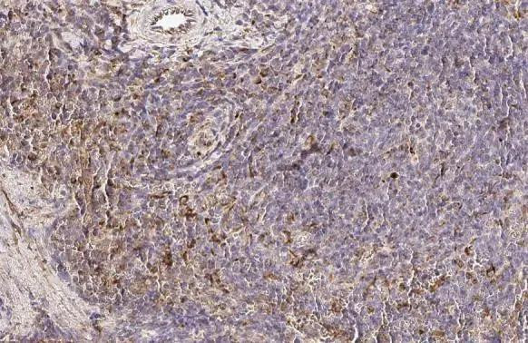 PFKFB4 Antibody in Immunohistochemistry (Paraffin) (IHC (P))