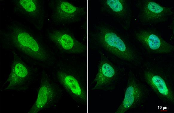 ULK2 Antibody in Immunocytochemistry (ICC/IF)