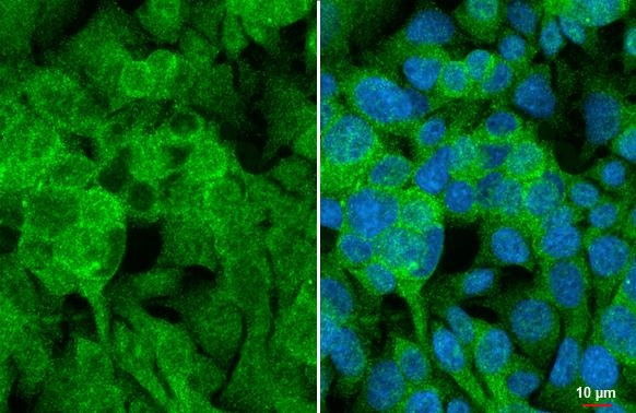 Angiogenin Antibody in Immunocytochemistry (ICC/IF)
