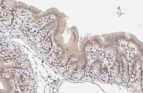 RelB Antibody in Immunohistochemistry (Paraffin) (IHC (P))