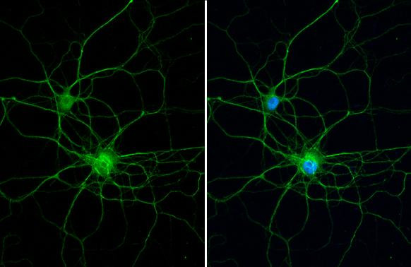 PKC gamma Antibody in Immunocytochemistry (ICC/IF)
