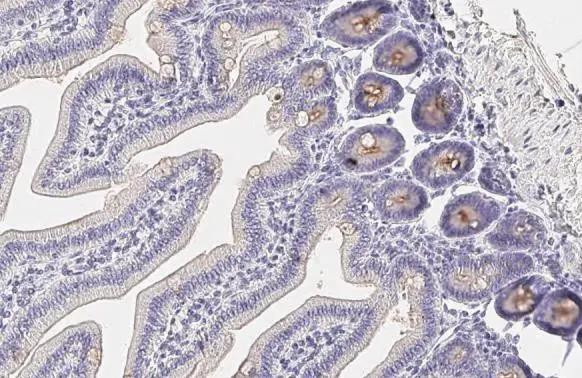 TMPRSS2 Antibody in Immunohistochemistry (Paraffin) (IHC (P))