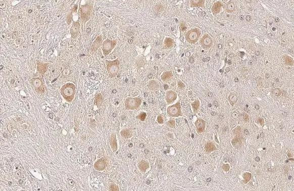 Sigma-1 Receptor Antibody in Immunohistochemistry (Paraffin) (IHC (P))
