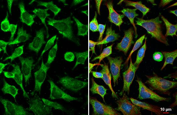 MLK4 Antibody in Immunocytochemistry (ICC/IF)