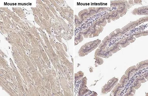 SPG7 Antibody in Immunohistochemistry (Paraffin) (IHC (P))