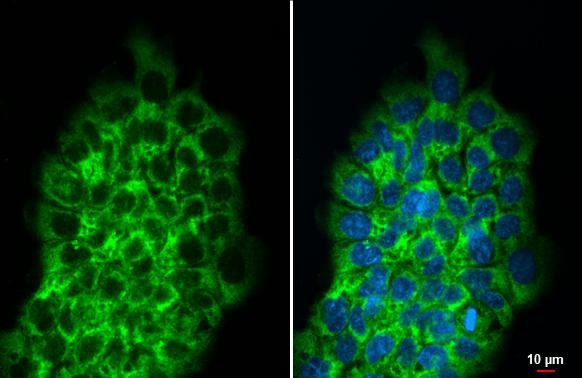 RPLP2 Antibody in Immunocytochemistry (ICC/IF)