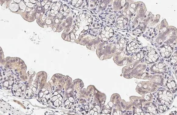 CARD10 Antibody in Immunohistochemistry (Paraffin) (IHC (P))