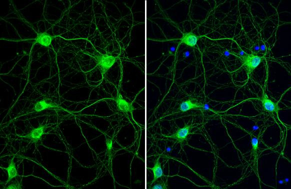 Cathepsin S Antibody in Immunocytochemistry (ICC/IF)