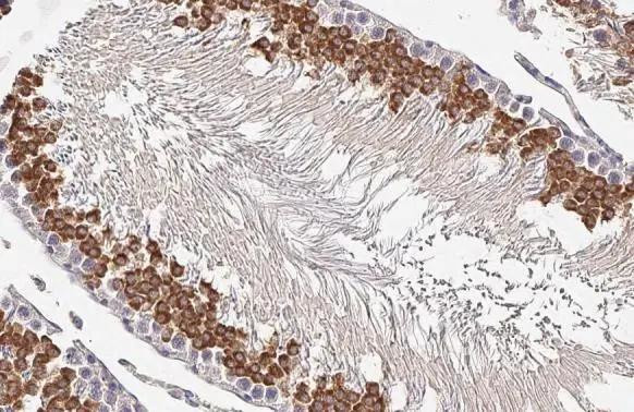 MNT Antibody in Immunohistochemistry (Paraffin) (IHC (P))