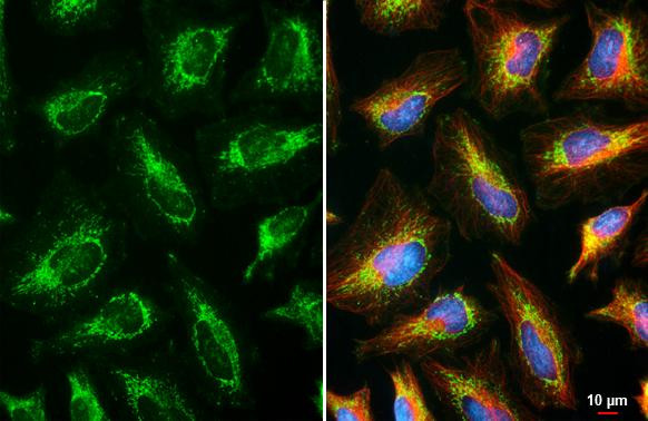 RNaseL Antibody in Immunocytochemistry (ICC/IF)